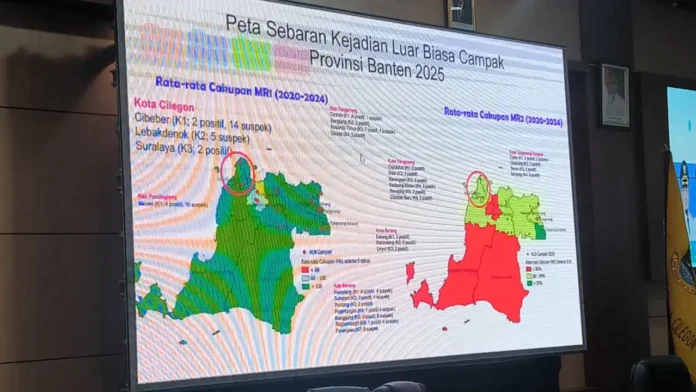 Lonjakan Campak Jadi KLB, Pemkot Cilegon Gerak Cepat Gelar Imunisasi Massal